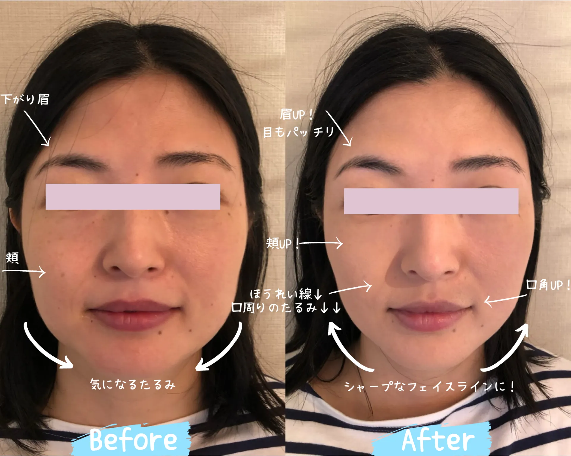 ビフォーアフター