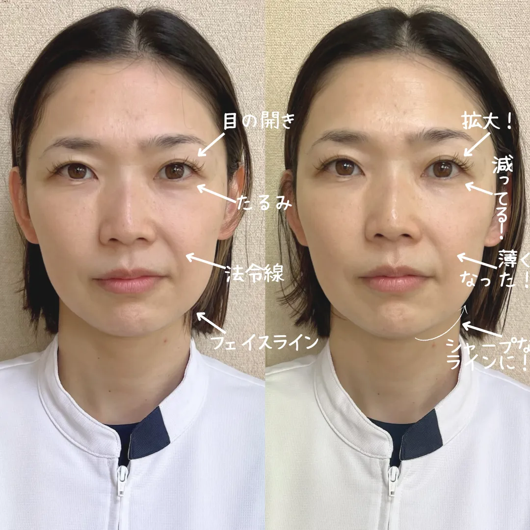 ビフォーアフター