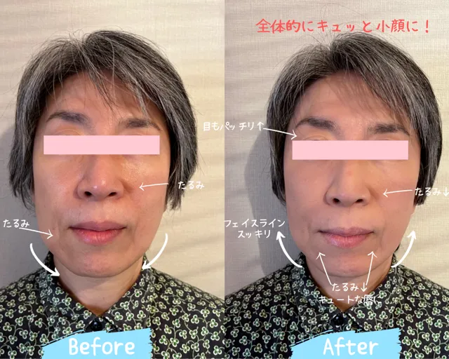 ビフォーアフター