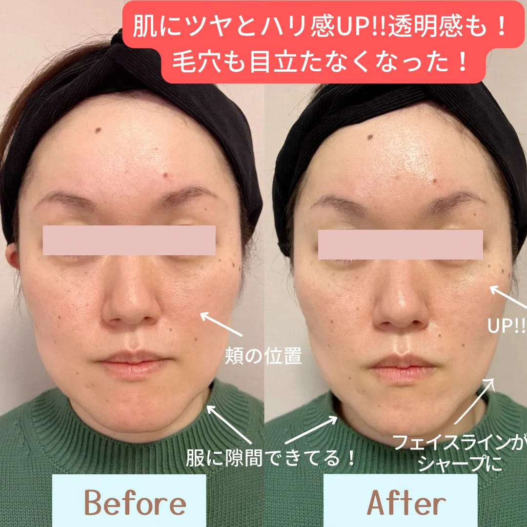 ビフォーアフター